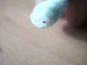 Un parasite ou une malformation ?, Picture 249.jpg