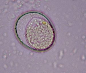 Photo de protozoaire grossit x40, Jus de terre et eau stagnante pour nos tubes de fondation ?
