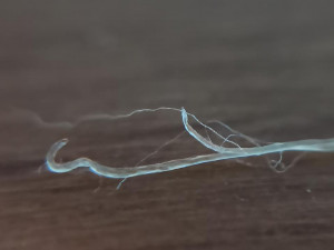 Photo 1, Vers parasites