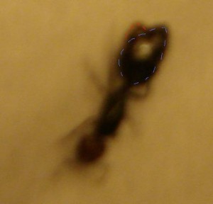 Blessure à l'abdomen, DSC05792.JPG