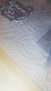 parasite observé pas loin (1), Parasite ou malformation ?