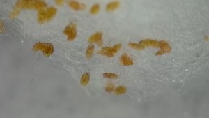 Truc mystère 3, Saletés, béstioles ou acariens
