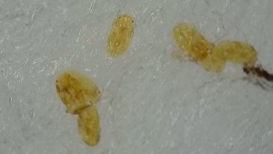 Truc mystère 2, Saletés, béstioles ou acariens